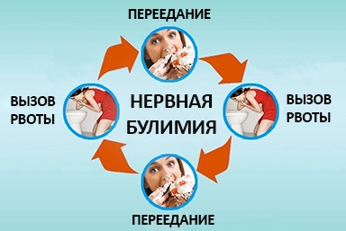 Лечение булимии в Завитинске